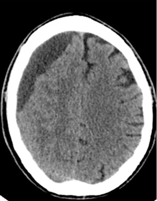 Preoperative CT imaging from Case 2.