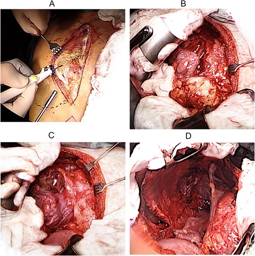 Perioperative situs.