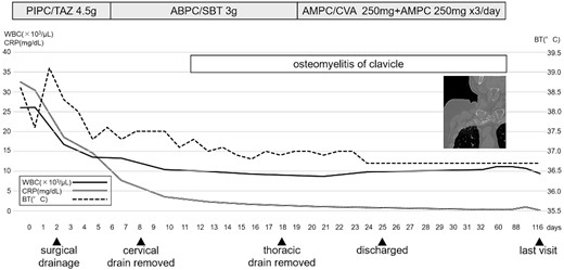Clinical course. PIPC/TAZ piperacillin/tazobactam, ABPC/SBT ampicillin/sulbactam, AMPC/CVA + AMPC amoxicillin/clavulanate+ amoxicillin, WBC white blood cell count, CRP C-reactive protein level, BT body temperature.