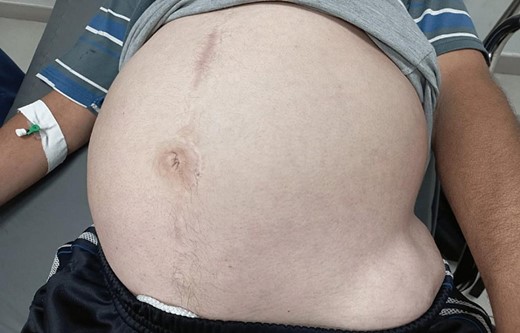 The patient’s abdomen at admission A.