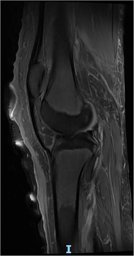 No further larva was noticed after 5 days.