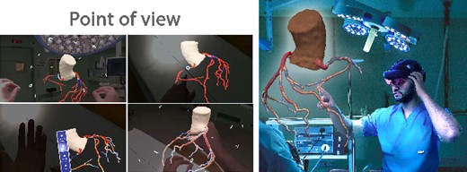 CoronaryXR platform. A user context is shown alongside a point of view of the system.