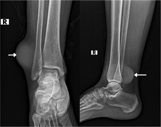 Radiological imaging pre-op.