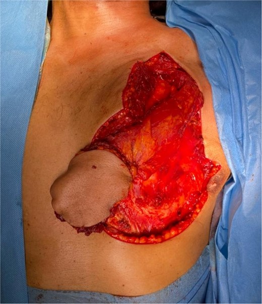 Levy of PMMF.