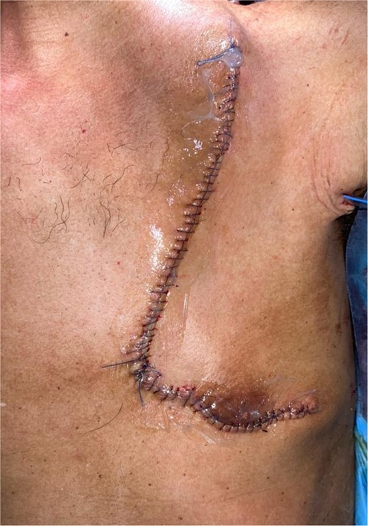 Closing of the sampling site.