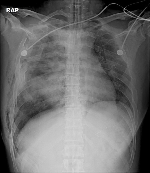 A simple radiograph of a 31-year-old man after injury.
