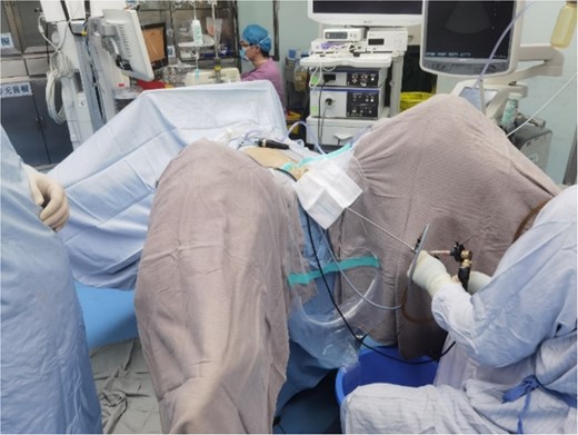 Percutaneous ureteroscopic lithotripsy.