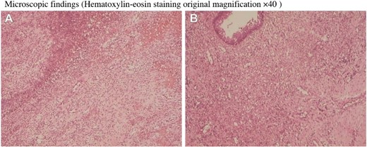 Microscopic findings.