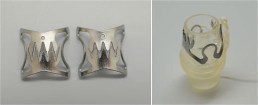 Over-the-scope clip (Ovesco Endoscopy AG, Tubingen, Germany)