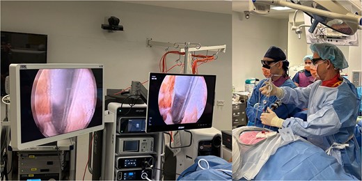 (a) 3D monitor (left) and 2D monitor (right); (b) operating theatre setup and polarization glasses worn to view 3D images.