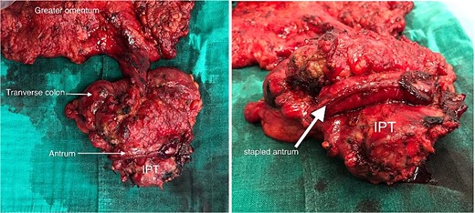 Macroscopic view of the specimen.