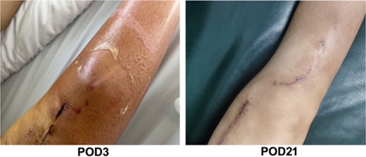 The images of physical examination result on the third and 21st day postoperation.