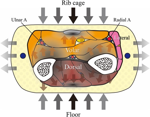 Schematic illustration of the hypothetical dynamic model in the cross-sectional view of the middle-distal third of the forearm (the possible mechanism of penetrating gangrene).