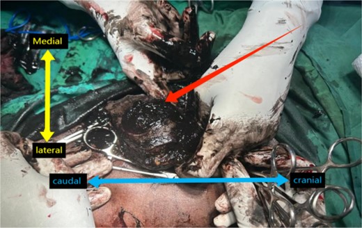 Intra-operative view of the left inguinal region with dark black, pigmented LNs. Orientation with the terms “Medial,” ”Lateral,” “Cranial,” and “Caudal” labeled.