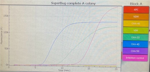 Amplification and anneal curves of amplified products of OXA-23 and OXA-40 genes of Acinetobacter baumannii.