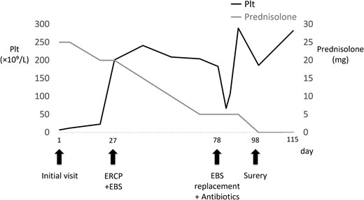 Time course, as well as trends of platelet counts and prednisolone dose. PLT, platelet count; ERCP, endoscopic retrograde cholangiopancreatography; EBS, endoscopic retrograde stent.