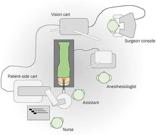 Configuration of the operative room for robot-assisted bilateral benign tonsillectomy using the da Vinci SP system. The da Vinci SP system is a robotic surgical system in three parts: the surgeon console, the vision cart, and the patient-side cart.