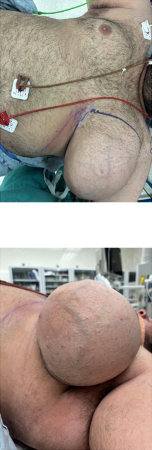 Preoperative gross imaging of the patient’s breast: (a) coronal view and (b) sagittal view.