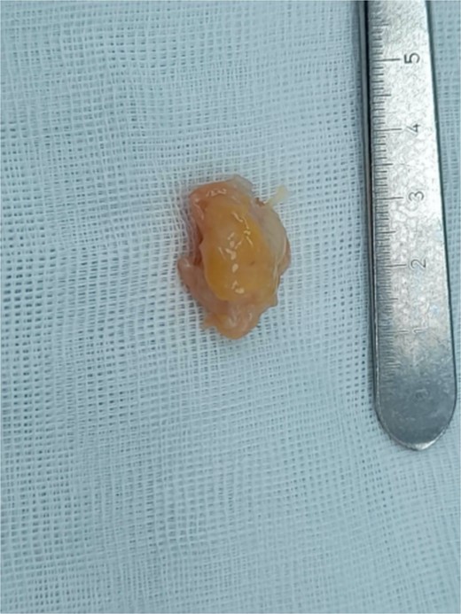 Macroscopic appearance of the specimen.