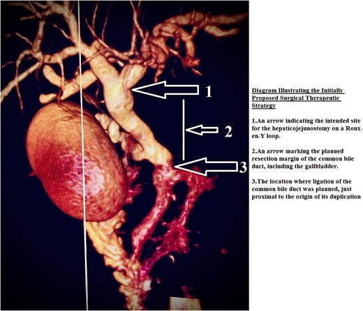 Diagram illustrating the initially proposed surgical therapeutic strategy.