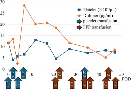 Graph showing the trends in postoperative coagulation parameters and the transfusion volumes of fresh frozen plasma and platelets. This indicates a prolonged consumption of coagulation factors postoperatively.