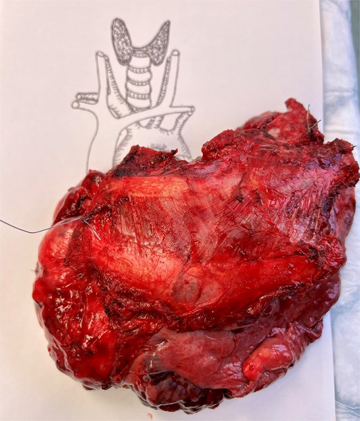 Macroscopic view of the resected specimen.