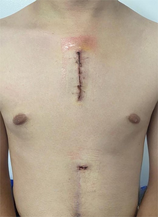 Outpatient follow-up.