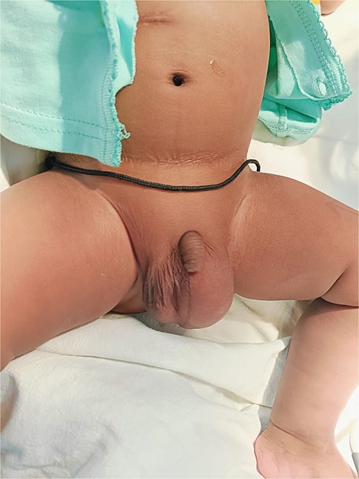 Clinical findings.