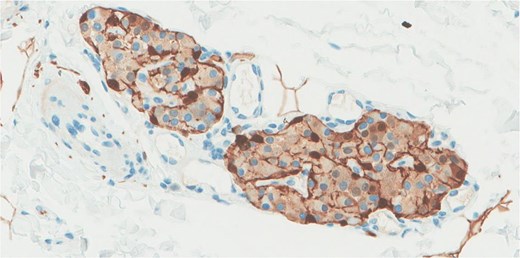 S100 immunohistochemical stain highlights the sustentacular cell.
