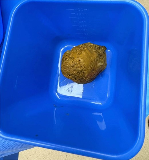 Inspissated material (enterolith) milked from the small bowel after enterotomy.