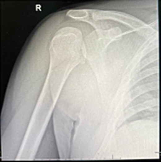 Initial X-ray.