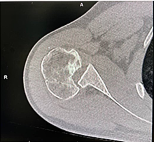 Initial CT scan.