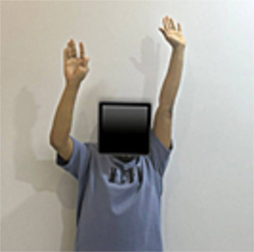 Range of motion 6 months post-operatively.