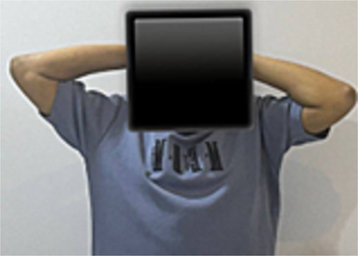 Range of motion 6 months post-operatively.