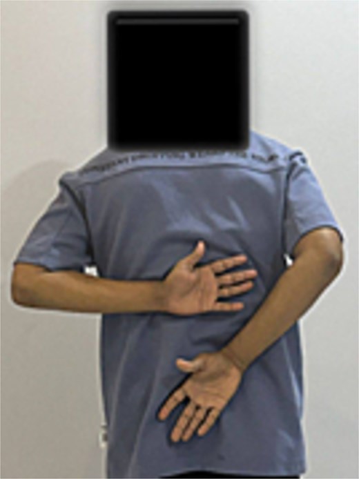 Range of motion 6 months post-operatively.