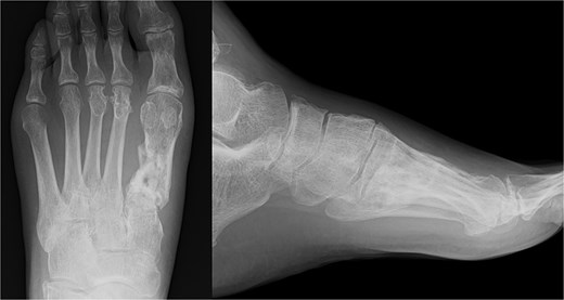 Radiography images 1 year after surgery.