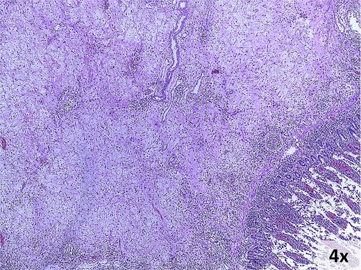 Microscopic findings. Hematoxylin and eosin-stained photomicrograph of the lesion.