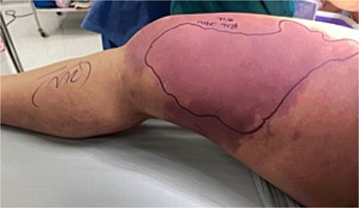 Right medial leg.