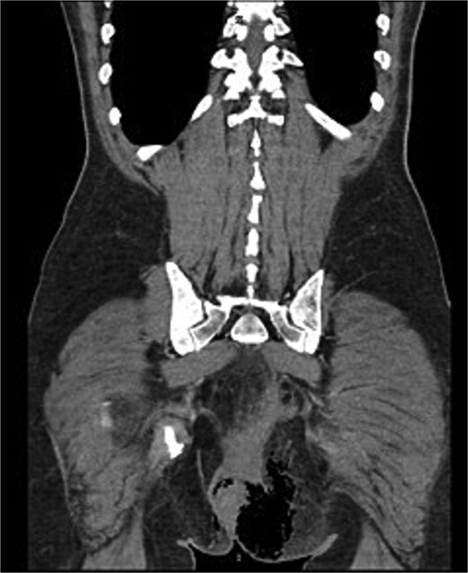 Diagnostic CT scan.