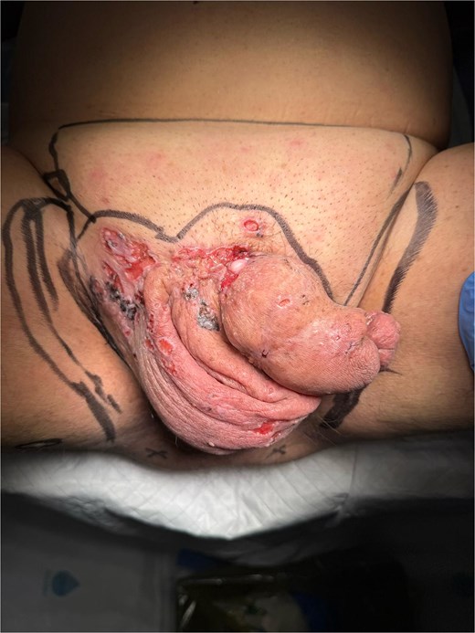 Clinical appearance and preoperative flap design.