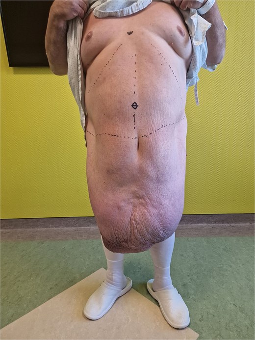 Clinical presentation from the front.