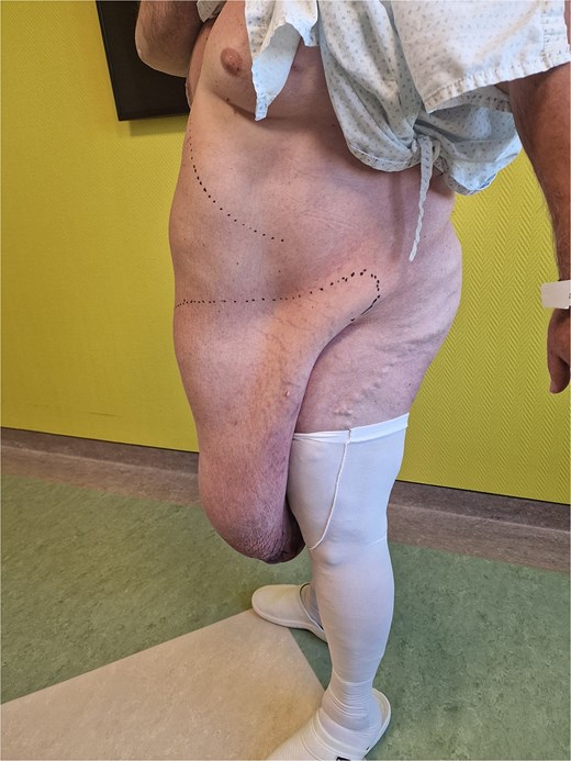 Clinical presentation from the side.