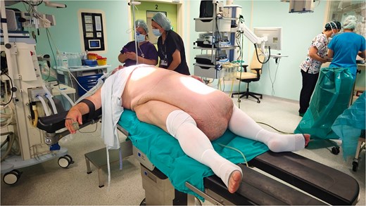 Patient’s position on the operating table.