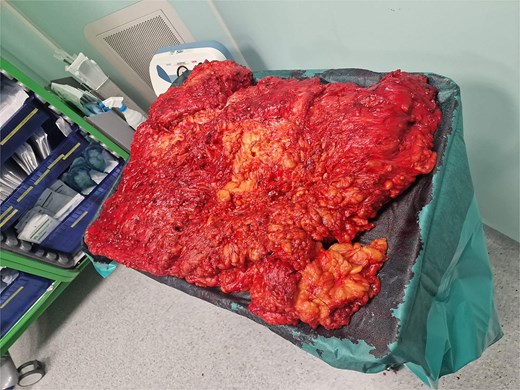 Removed specimen with a measured weight of 35 kg.