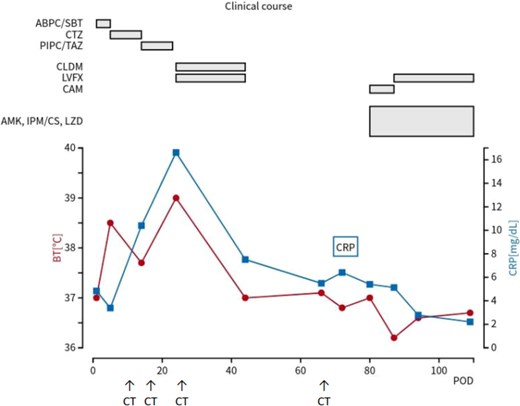 Clinical course of the patient. The red line represents body temperature, and the blue line indicates CRP levels. The upper section shows the timeline of antibiotics administered. CRP, C-reactive protein; POD, postoperative day; BT, body temperature; ABPC/SBT, ampicillin/sulbactam; CAZ, ceftazidime; PIPC/TAZ, piperacillin/tazobactam; LVFX, levofloxacin; CLDM, clindamycin; AMK, amikacin; IPM/CS, imipenem/cilastatin; LZD, linezolid; CAM, clarithromycin.
