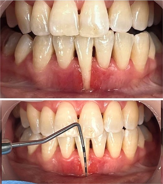 Preoperative clinical status.