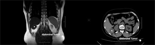 The MRI and the CT examination.