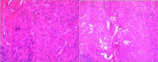 Pathological report.