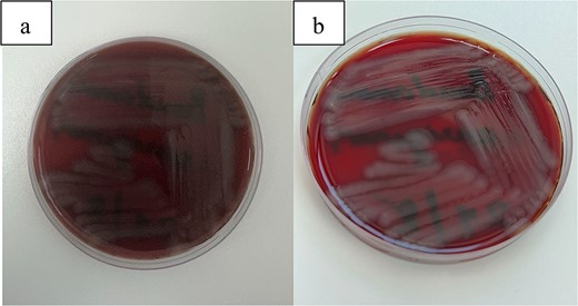 (a, b) This figure illustrates the characteristic growth of Pseudomonas aeruginosa on blood agar plates.