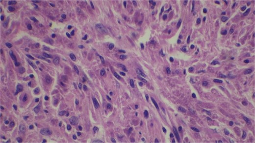 H and E stain.